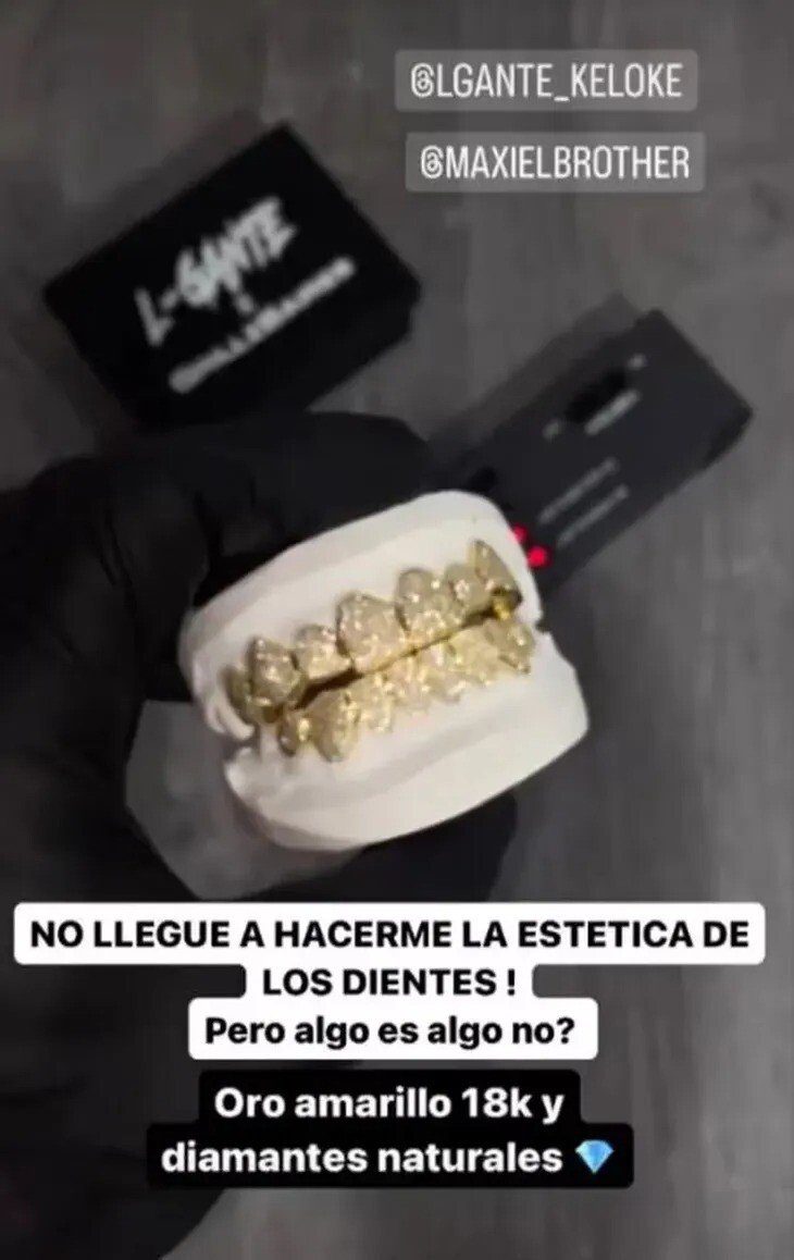 La nueva dentadura que L-Gante ostentó en redes.