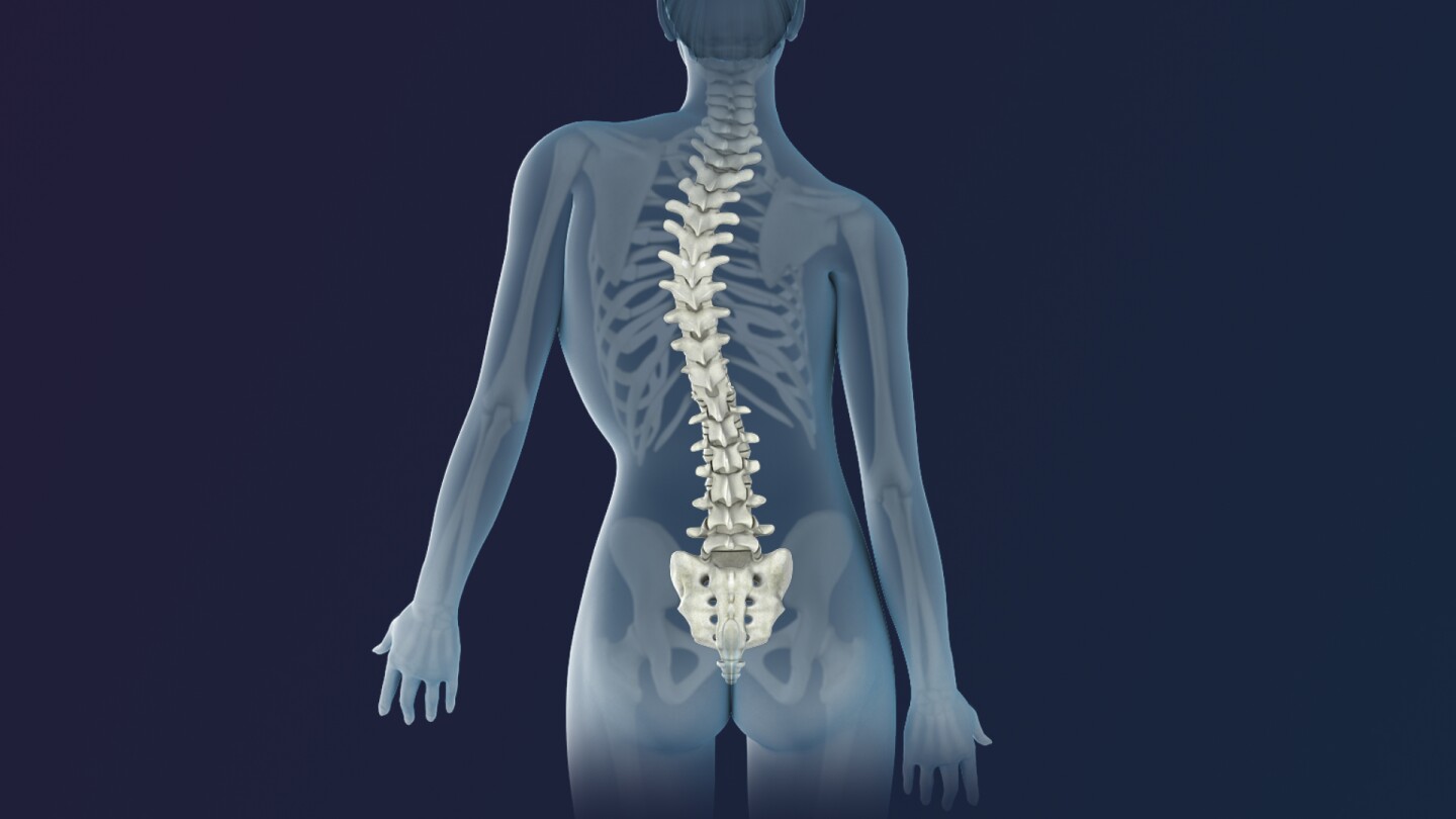 Escoliosis.jpg