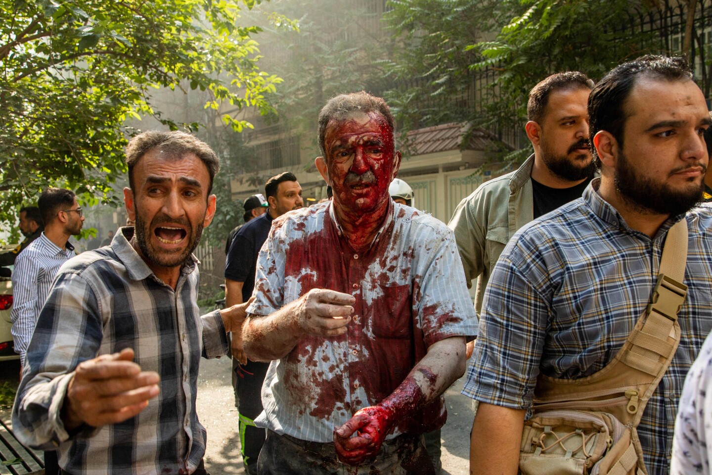 Iraníes atienden a un hombre que resultó herido en un presunto ataque israelí en el bulevar Keshavarz en el centro de Teherán.