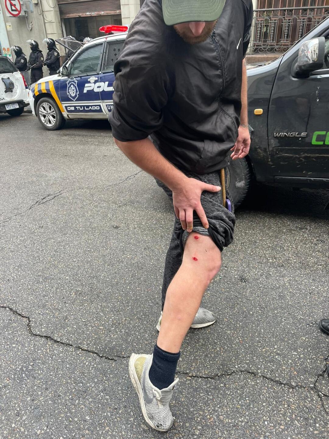 Matias Kherlopian, a member of the fishing union near the Ministry of Labor, showed wounds caused by rubber bullets.