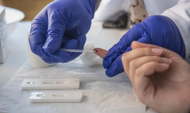 Realización de un test rápido para la detección del VIH.